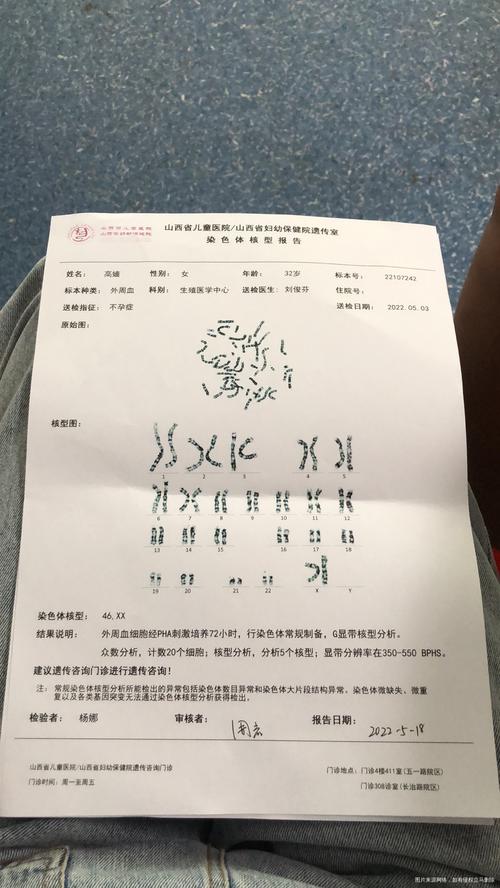 三代试管婴儿能避免染色体异常吗
